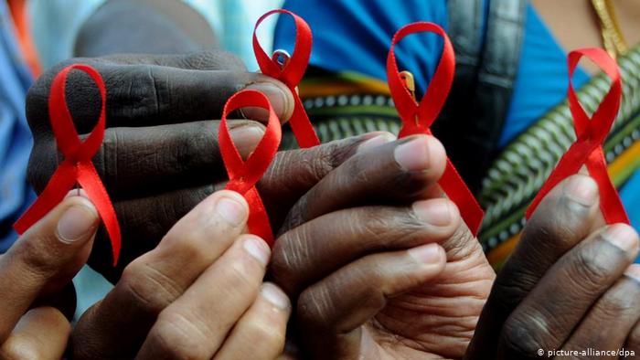 SIDA matou mais de 50 mil pessoas em 2018 no país
