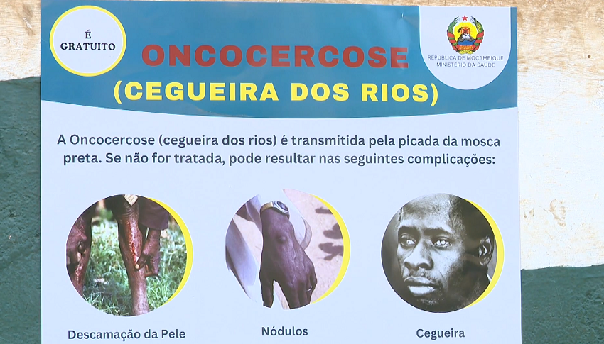 Tratamento da cegueira dos rios: A terapia vai abranger 202 mil pessoas em Sanga e Lago